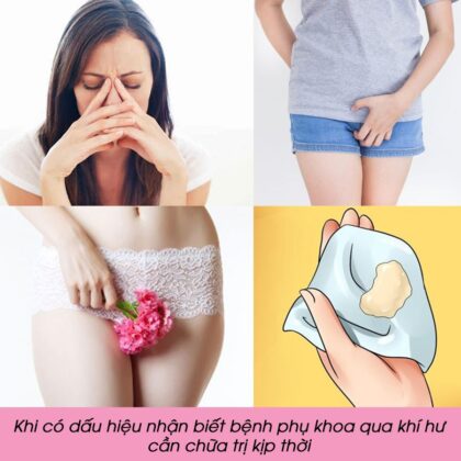 Cách tránh viêm nhiễm âm đạo